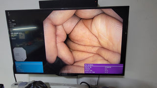 Olympus PCF-Q180AL Pediatric Video Colonoscope